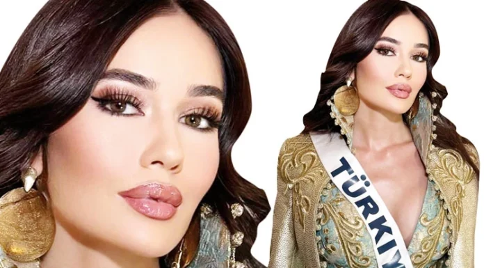 Ceren Arslan: Büyük gün bugün destek bekliyorum