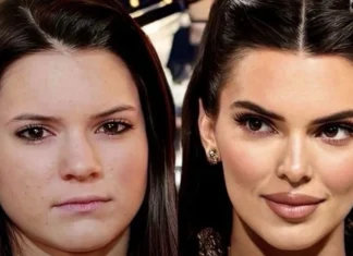 Kendall Jenner estetik iddialarını cevapladı