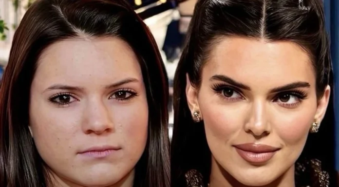 Kendall Jenner estetik iddialarını cevapladı