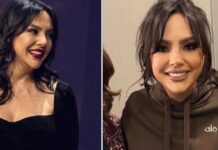 Ebru Gündeş’in estetik sonrası son hali gündem oldu