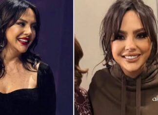 Ebru Gündeş’in estetik sonrası son hali gündem oldu