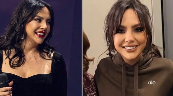 Ebru Gündeş’in estetik sonrası son hali gündem oldu